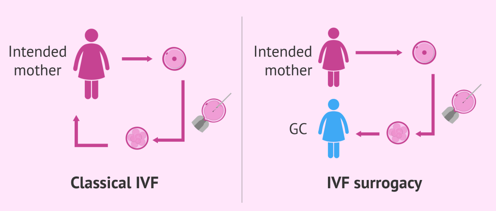 Parental Rights in Surrogacy: A Complete Legal Guide